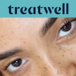 Treatwell teal banner with close-up of naturally lifted lashes after a Korean lash lift on freckled skin