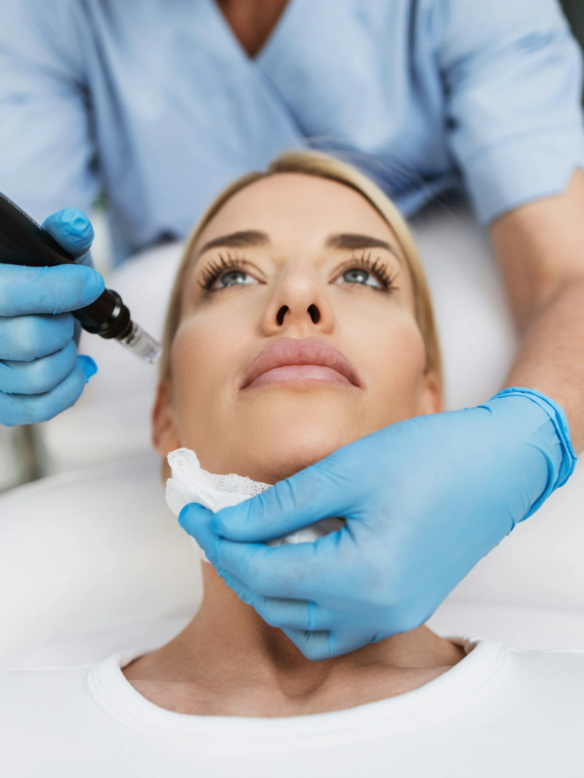 Gros plan du visage d'une femme allongée sur un lit de soin, en train de recevoir un soin de microneedling en clinique