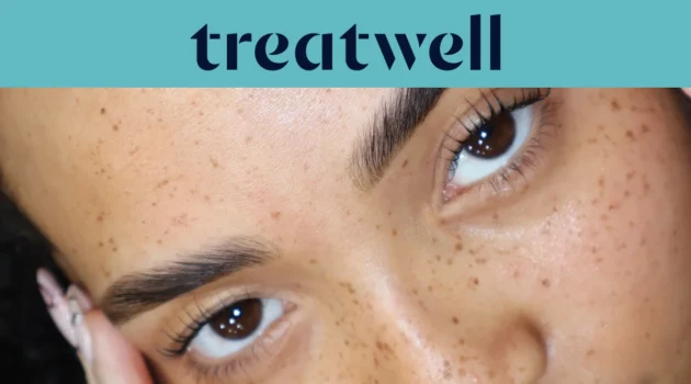 Bannière Treatwell turquoise avec un gros plan sur des cils naturellement rehaussés après un rehaussement de cils coréen, sur une peau constellée de taches de rousseur