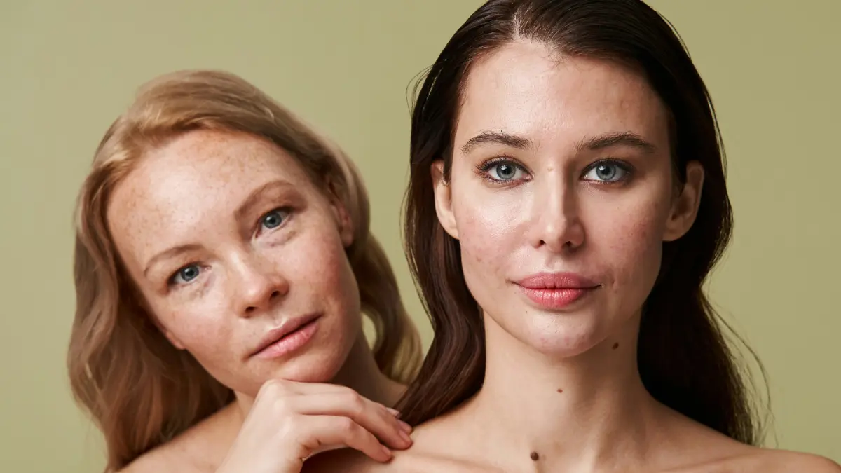 Une femme blonde avec des taches de rousseur regarde par-dessus l'épaule d'une femme brune à la peau acnéique