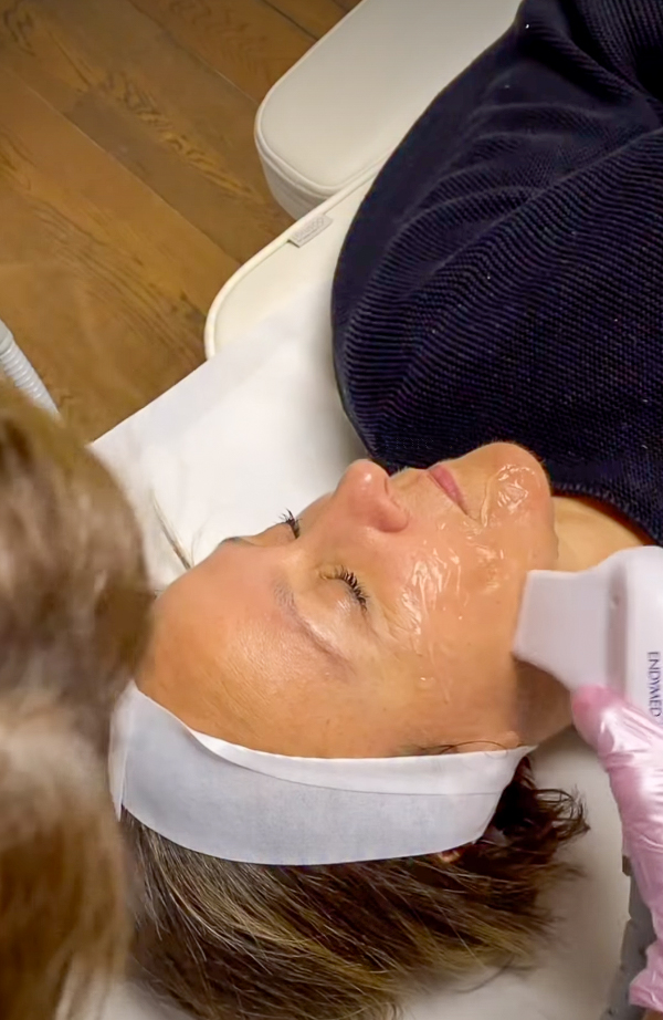 Radiofrequentie-facial, IG @sadaf_jaffari | Treatwell