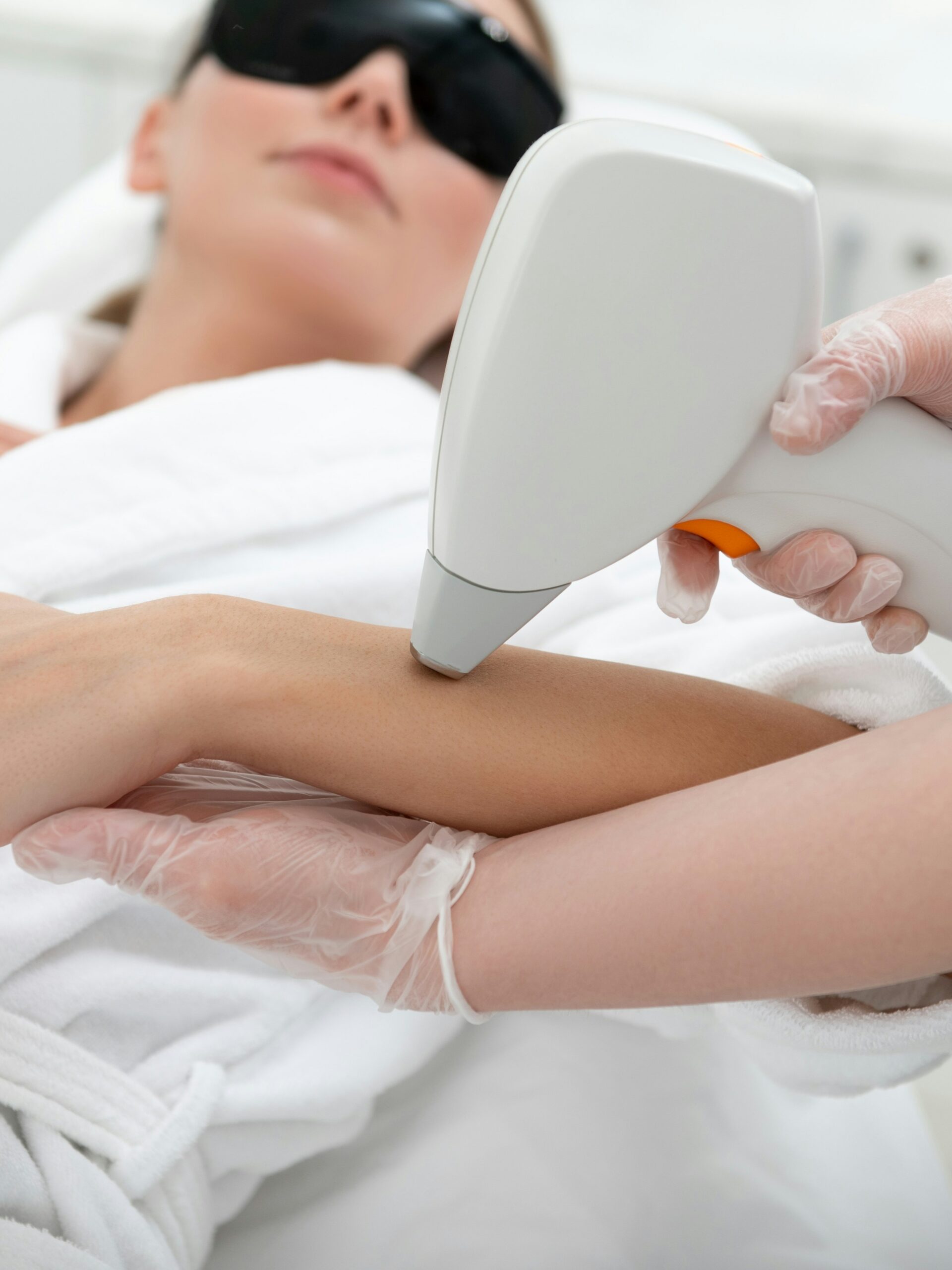 Vrouw krijgt een IPL-behandeling op haar arm in een kliniek