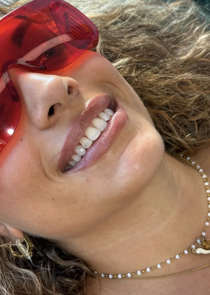 Close-up van een lach met twee kleine kristallen tooth gems op de ondertanden, zomers portret