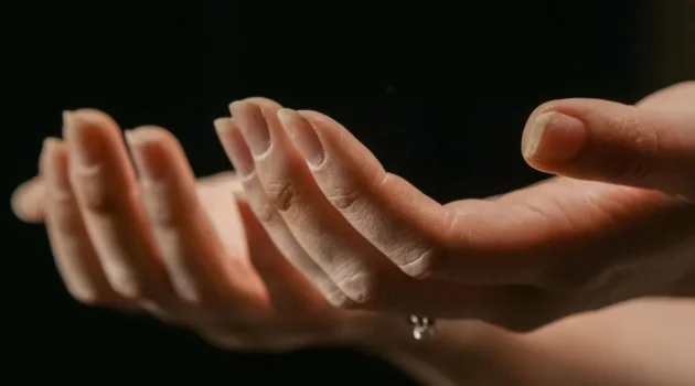 Twee handen naar voren gestrekt met de handpalmen omhoog en afbladderende nagels